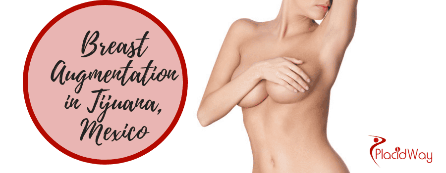 Breast Augmentation in Tijuana Mexico